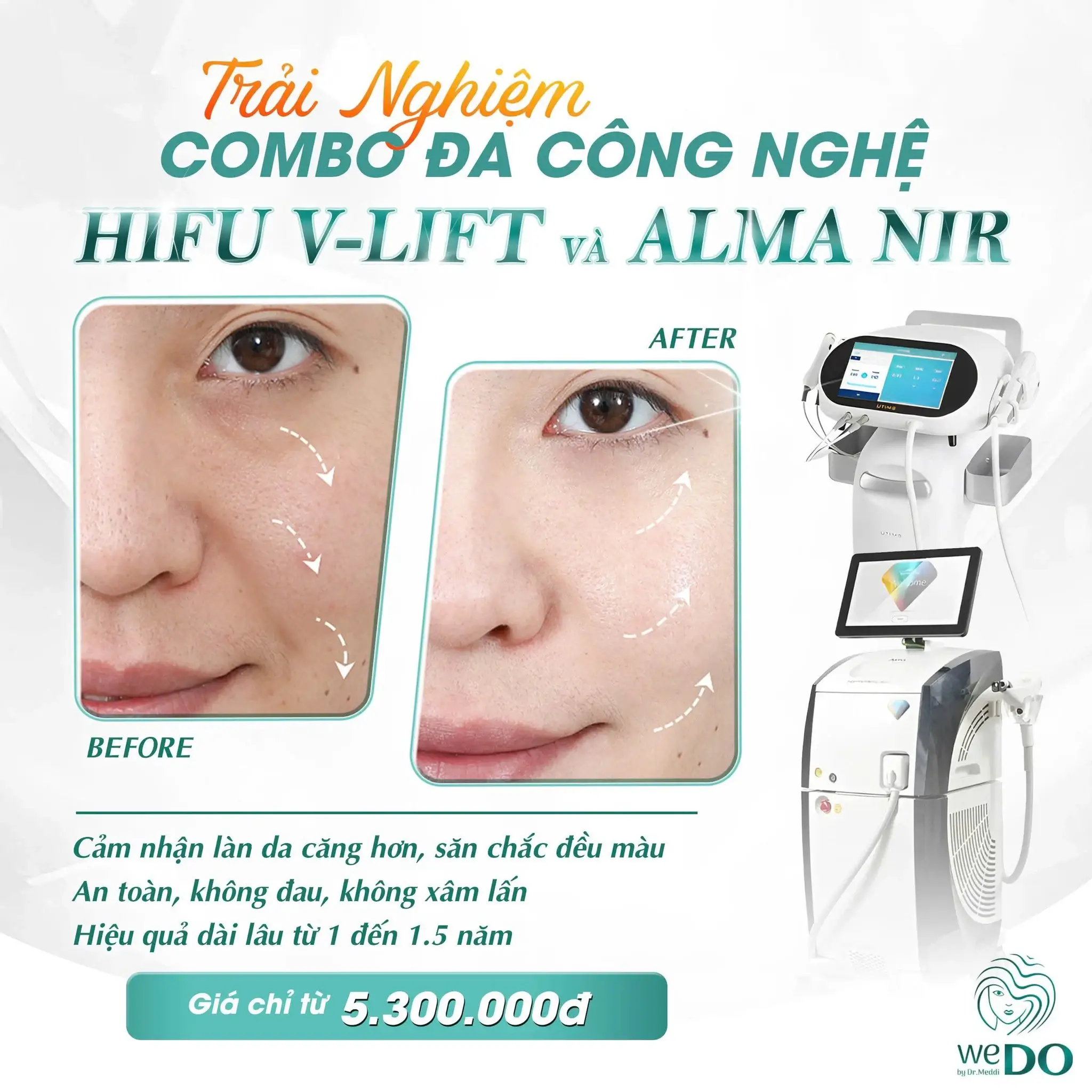 Alma NIR – Activating Collagen for Radiant Skin 