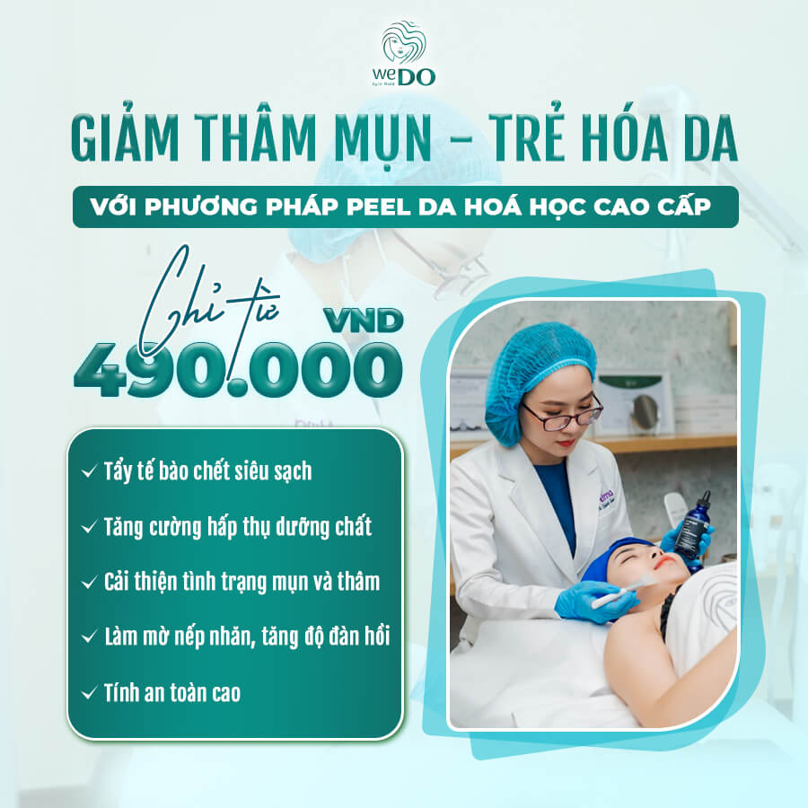 Chemical Peel “CÂU TRẢ LỜI” CHO LÀN DA KHÔNG SẦN – KHÔNG MỤN  Chỉ từ 490K