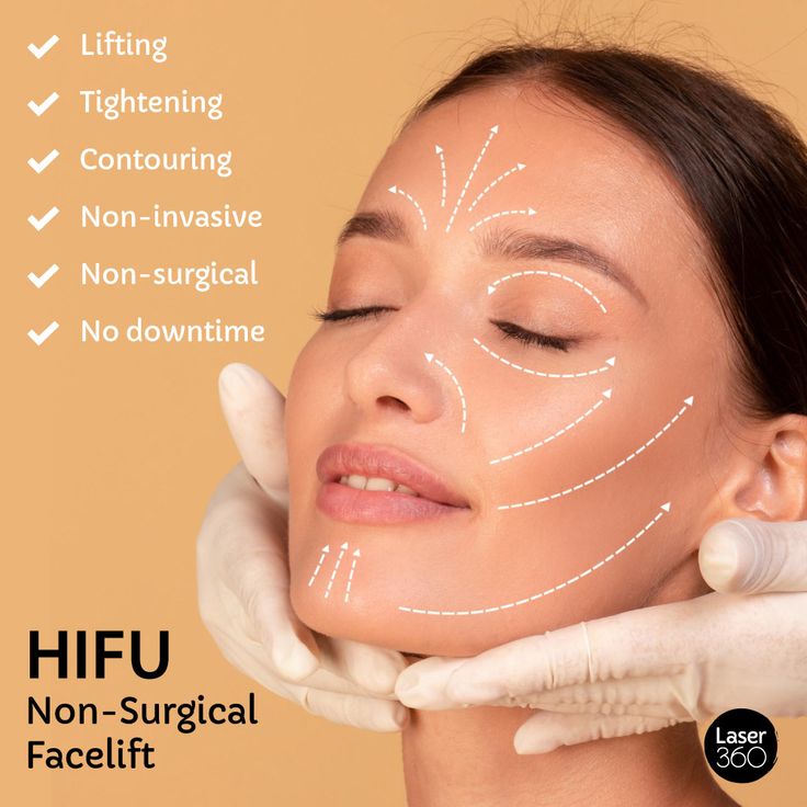 CÁC ỨNG DỤNG CỦA CÔNG NGHỆ HIFU