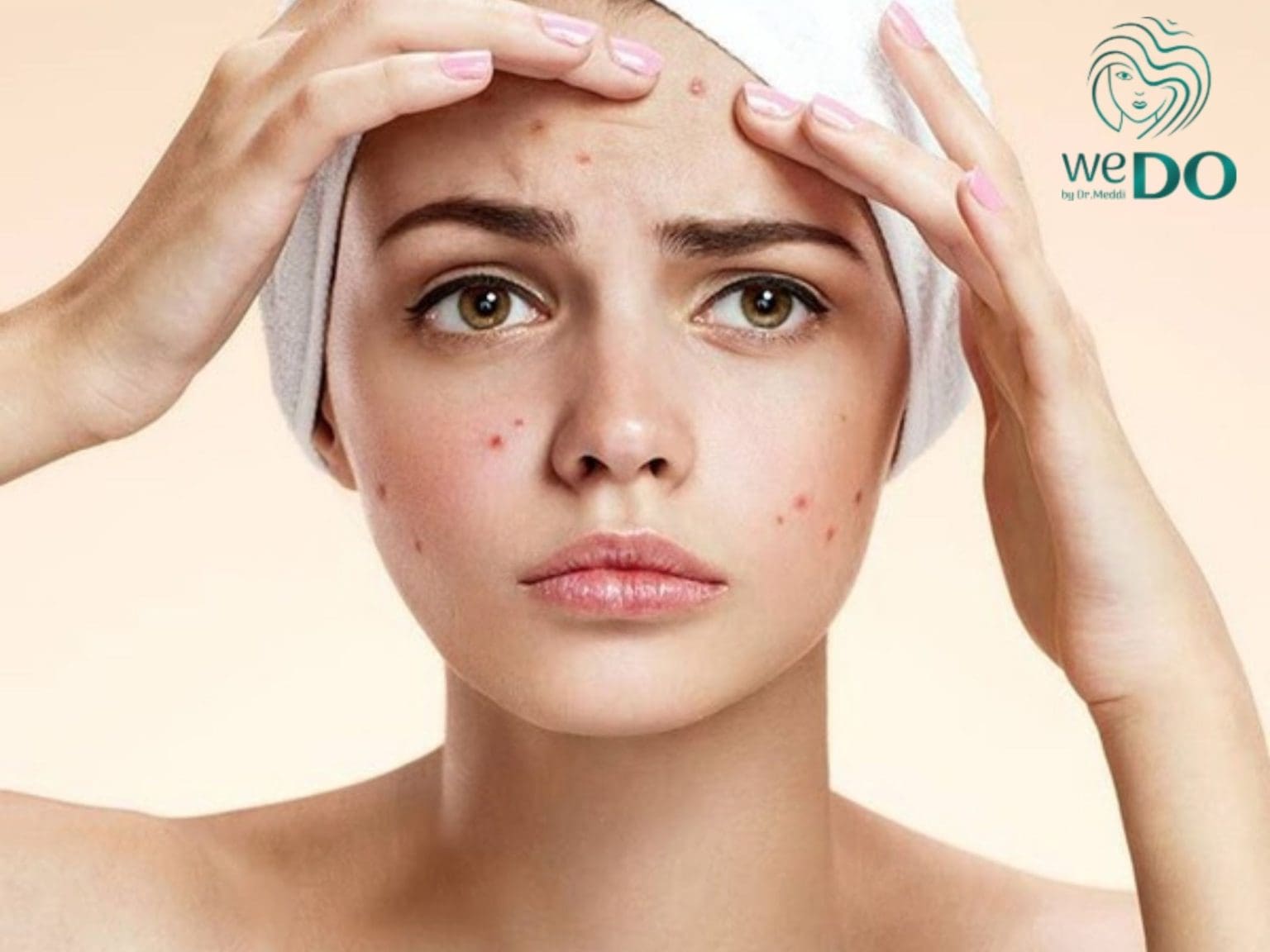 WEDO SKINCLINIC – ĐỊA CHỈ ĐIỀU TRỊ MỤN TẠI TP.HCM UY TÍN, HIỆU QUẢ