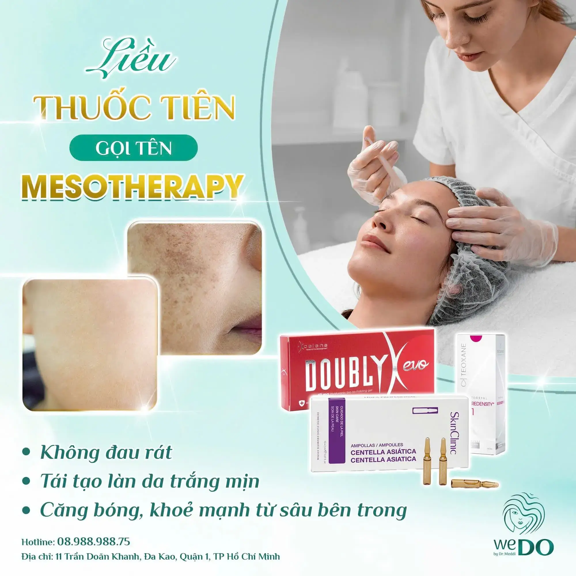 MESOTHERAPY – LIỀU THUỐC TIÊN CHO DA TÀN NHANG