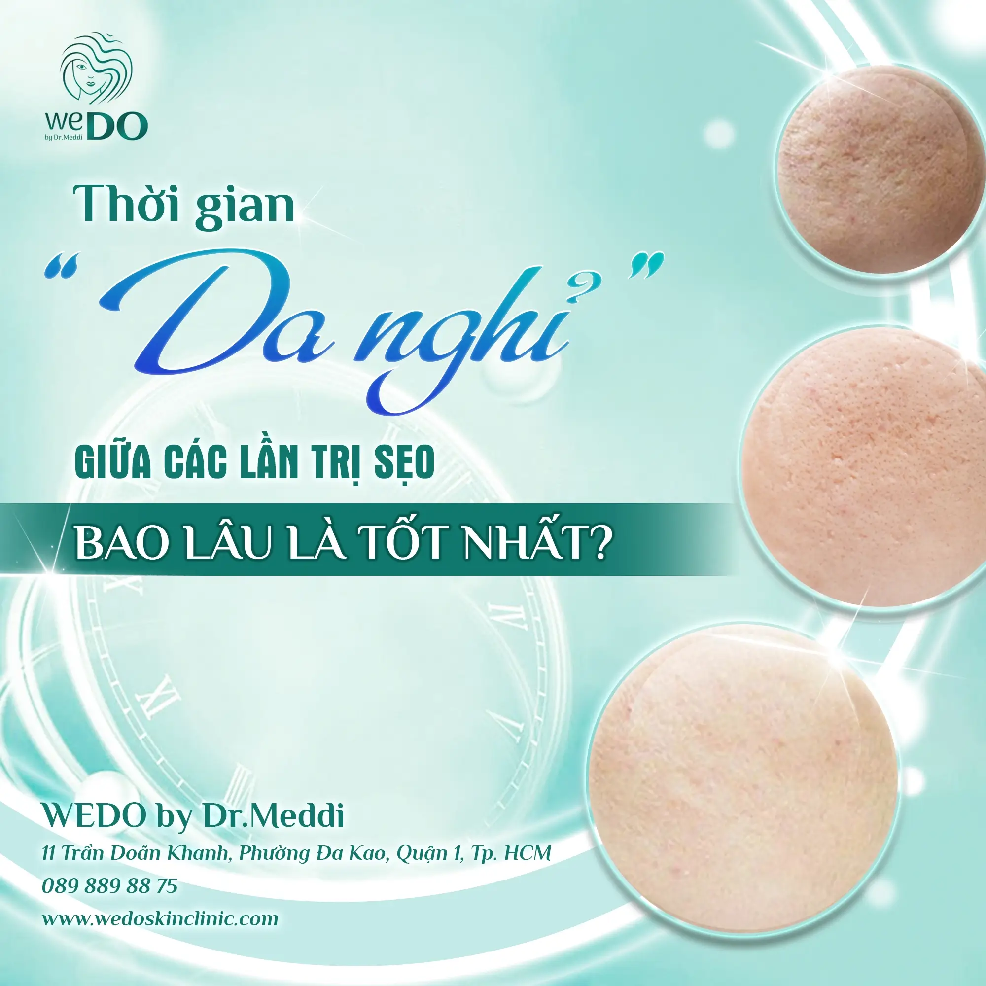 Thời gian nghỉ giữa 2 lần điều trị Sẹo – Bao lâu là tốt nhất?