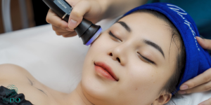 advanced-laser-in-acne-treatment-in-hcm-thumbnail